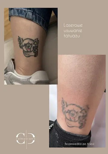 CALMADRAMA TATTOO